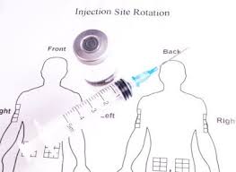 Insulin Injection Site Rotation Archives Mydario Com