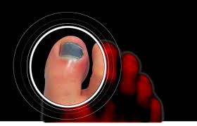 physician after painful toenail injury