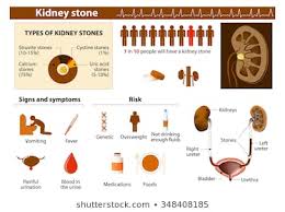 Kidney Stones Images Stock Photos Vectors Shutterstock
