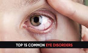 common eye disorders and diseases