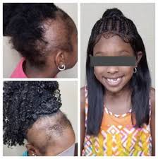 See more ideas about hair growth, hair remedies, natural hair styles. Ethnic Hair How To Prevent Damage From Braids Weaves And Wigs The Hair Society