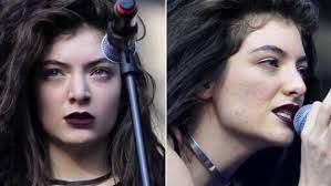 lorde bares her acne to prove flaws