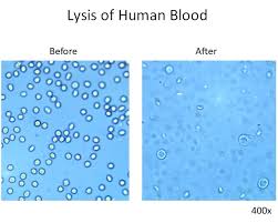 p5w7 101bio red blood cell lysis buffer