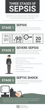 what are the three ses of sepsis