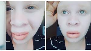 albino woman s review of fenty beauty