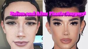 you beauty guru plastic surgery