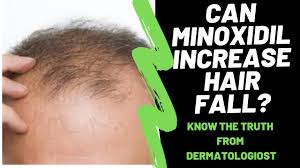 can minoxidil increase hair fall