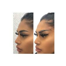 Even though cat eye issues can be dangerous, the good news is that in most cases, you can spot them rather quickly. Fox Eyes Thread Lift Harley Street Dr M Saleki Fox Eyes London