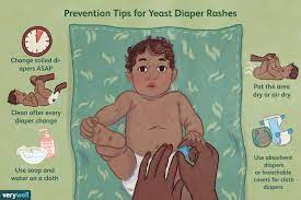 yeast diaper rash symptoms treatment