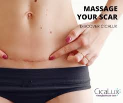 The procedure takes about 45 to 60 minutes. Don T Be Afraid To Massage Your C Section Scar Cicalux