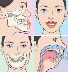 what is orthognathic surgery