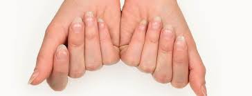 white spots on your nails think zinc