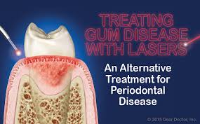 treating gum disease with lasers an