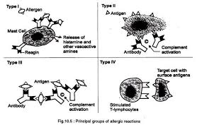 Allergic Reactions Types And Mechanism With Diagram