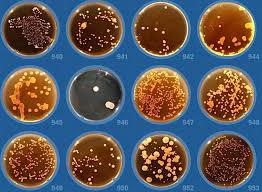 Identifying Bacteria In Petri Dishes Petri Dish Dishes