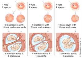 Twins And Multiple Babies