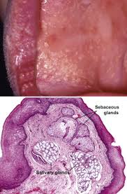 salivary mucous gland an overview