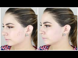 face makeup for acne scarring