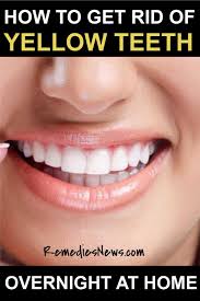 This is the wisest, and also the most efficient way to whiten teeth, but, it can … Pin On Teeth Whitening