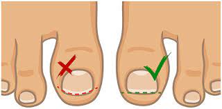 diabetes foot care how to look after