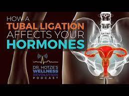 hormonal side effects of a tubal ligation