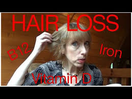 is your hair loss caused by vitamin d