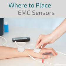 Where To Place Emg Electrode Sensors For Biofeedback Treatment