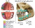 نتیجه تصویری برای اولین دندان دائمی در چه سنی می روید