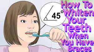 Can you use baking soda as a whitening agent? How To Whiten Your Teeth When You Have Braces How To Whiten Teeth With Braces Within 3 Wonder Ways Youtube