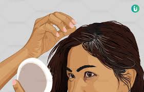grey hair causes symptoms treatment