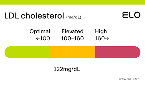 ldl cholesterol 122 mg dl