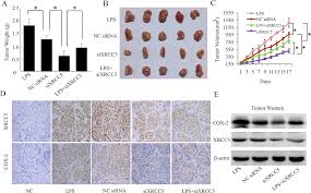 People who have had surgery for colorectal people with a family history of hereditary nonpolyposis colon cancer. Plos One Xrcc5 Cooperates With P300 To Promote Cyclooxygenase 2 Expression And Tumor Growth In Colon Cancers