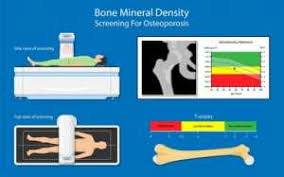 bone density test purpose types and t