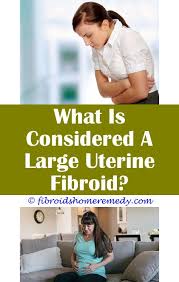 Pin On Uterine Fibroid Size Chart