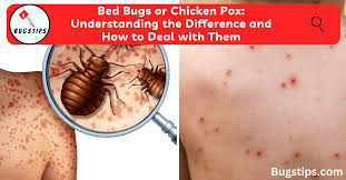 bed bugs or en pox understanding