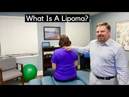 understanding lipomas definition