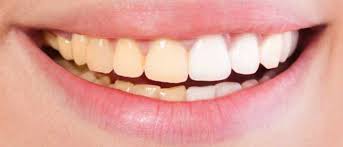 Are Yellow Teeth Stronger Bbc Science Focus Magazine