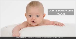cleft lip and cleft palate causes