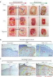 Fourth, fifth and sixth degree burns penetrate skin wounds in older adults often heal more slowly, and that makes a burn more likely to become infected. Dual Therapeutic Functions Of F 5 Fragment In Burn Wounds Preventing Wound Progression And Promoting Wound Healing In Pigs Sciencedirect