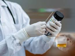 Urine Ph Normal Ranges And What They Mean