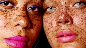 skin pigmentation s to help