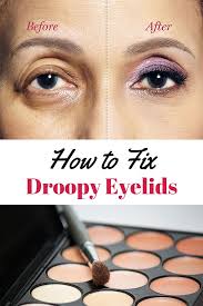 how to fix droopy lids how to correct