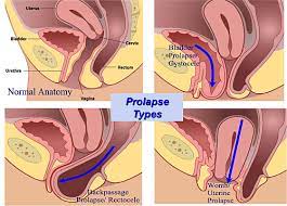 gynecological surgery mark j at