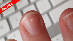 white spots on your finger nails
