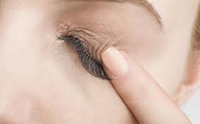 eyelid rash dermais causes and