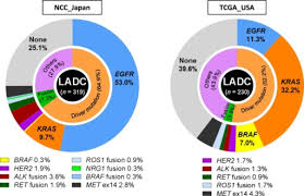 Frequencies Of Driver Oncogene Aberrations In Lung Aden Open I