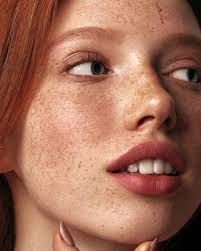 fun facts about freckles for s not