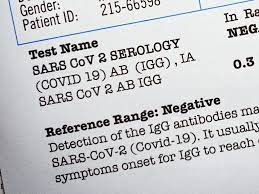 Peter phillips, a clinical professor of infectious diseases at the. How Do I Get My Covid 19 Test Results Mainstreet Family Care