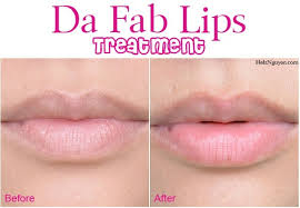 treatment for healthier lips diy