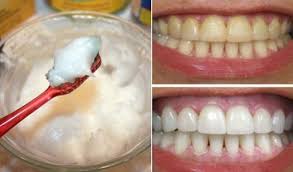 When you consider how much we put our teeth through, it's no wonder that they may get stained along the way. Say Bye Bye To Yellow Teeth Naturally Whiten Your Teeth At Home Tezz Buzz English Dailyhunt